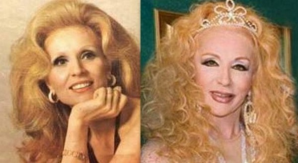 Arab Celebrities Before After